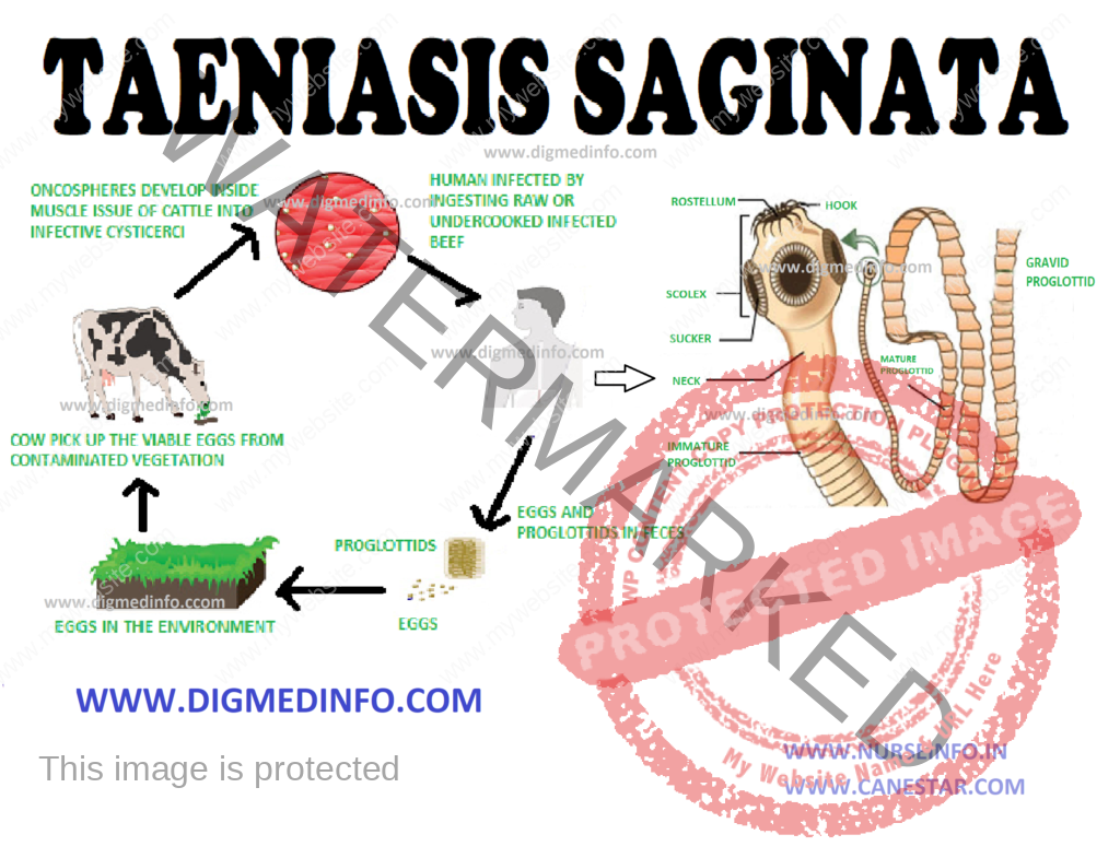 UNARMED TAPEWORM (Taeniasis saginata) (Beef Tapeworm) – General Characteristics, Life Cycle, Clinical Features, Diagnosis, Treatment and Prevention 