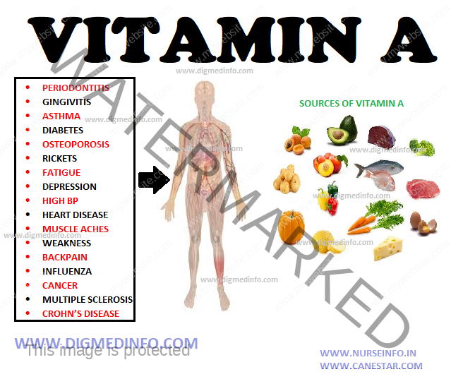 FAT SOLUBLE VITAMINS – VITAMIN A – Deficiency, Clinical Features, Treatment, Prevention and Toxicity 