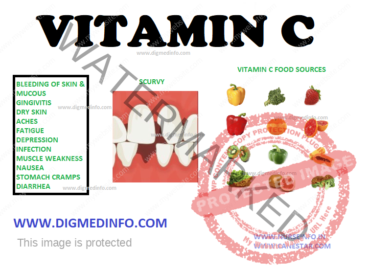  ASCORBIC ACID – SCURVY (ANTISCORBUTIC VITAMIN – VITAMIN C)  PHYSIOLOGICAL ACTIONS, SCURVY, TREATMETN AND PREVENTION AND OVERDOSE