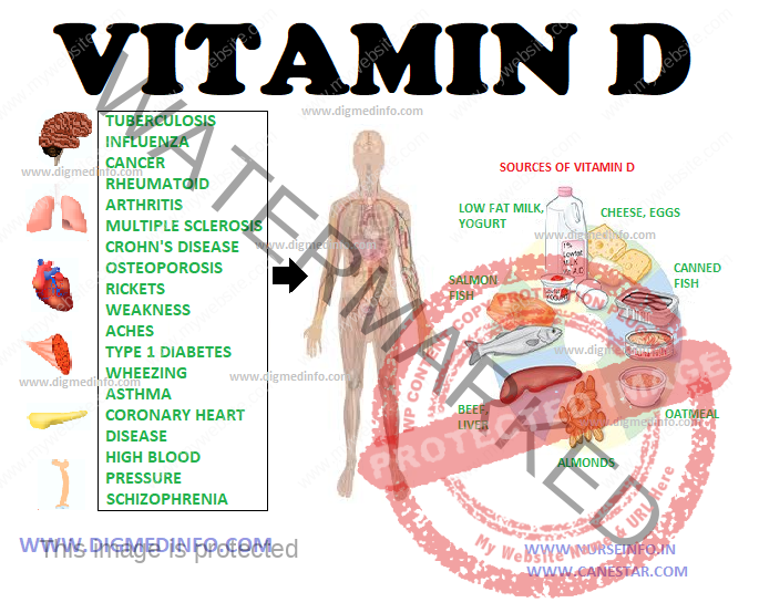 VITAMIN – D – Biological Actions, Daily Requirements, Rickets, Clinical Features, Diagnosis, Treatment and Prevention 