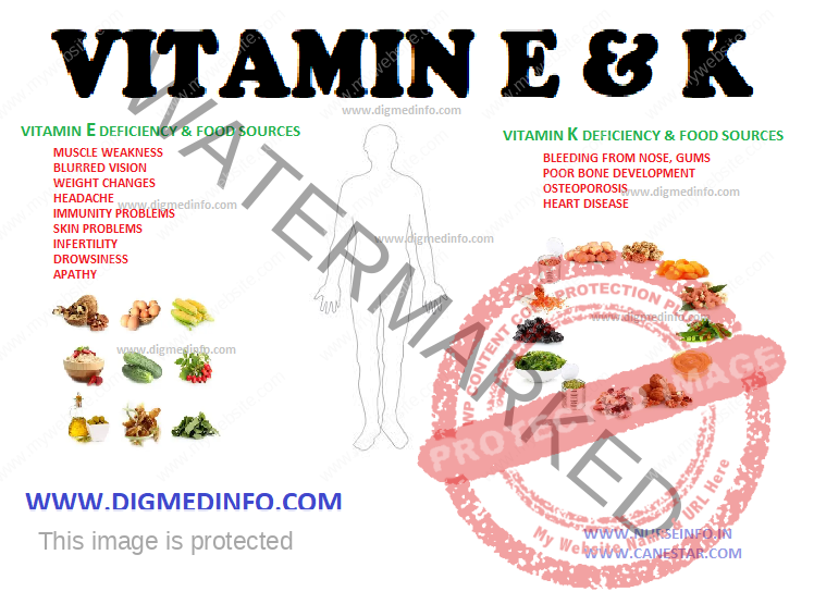 VITAMIN E AND K (Fat Soluble Vitamin) – Dietary Sources, Clinical Features, Treatment and Prevention 