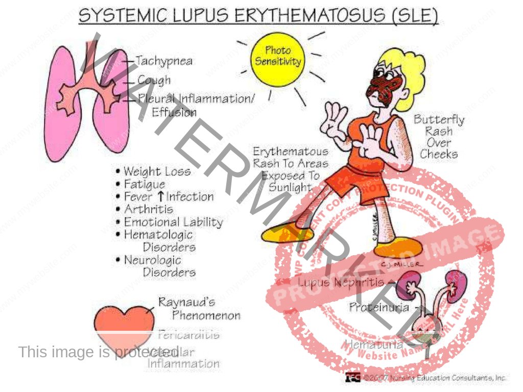 Nursing Mnemonics Book for NCLEX-RN, CRNE AND NMC Examination | nurseinfo