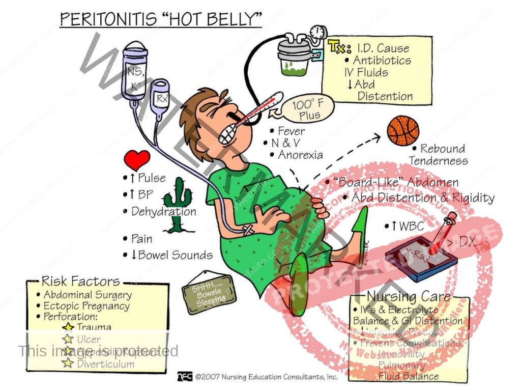 Nursing Mnemonics Book for NCLEX-RN, CRNE AND NMC Examination | nurseinfo